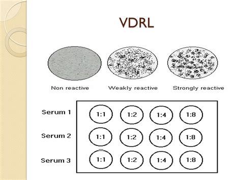vdrl test non reactive|RPR.
